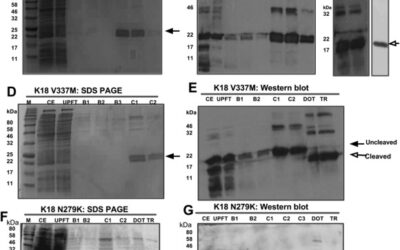Expression and purification of tau protein and its frontotemporal dementia variants using a cleavable histidine tag.