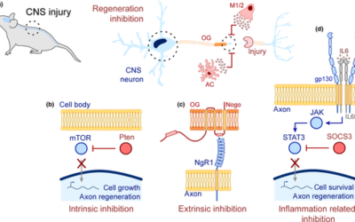 Construction and reconstruction of brain circuits: normal and pathological axon guidance.