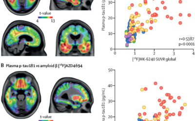 Blood phosphorylated tau 181 as a biomarker for Alzheimer’s disease: a diagnostic performance and prediction modelling study using data from four prospective cohorts.