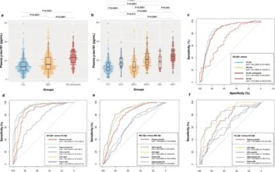 Diagnostic performance and prediction of clinical progression of plasma phospho-tau181 in the Alzheimer’s Disease Neuroimaging Initiative.