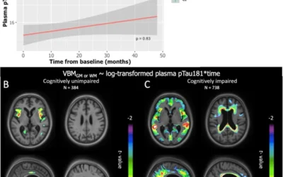 Plasma pTau181 predicts cortical brain atrophy in aging and Alzheimer’s disease.