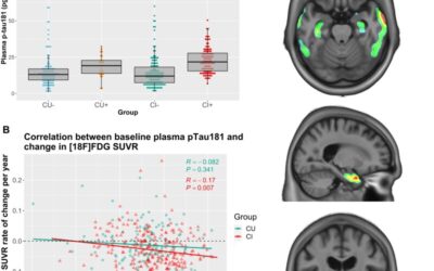 Plasma levels of phosphorylated tau 181 are associated with cerebral metabolic dysfunction in cognitively impaired and amyloid-positive individuals.