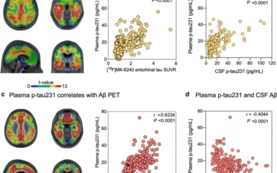 Plasma p-tau231: a new biomarker for incipient Alzheimer’s disease pathology.