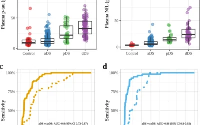 Phosphorylated tau181 in plasma as a potential biomarker for Alzheimer’s disease in adults with Down syndrome.