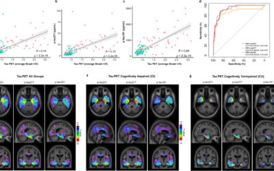 Cerebrospinal fluid p-tau231 as an early indicator of emerging pathology in Alzheimer’s disease.