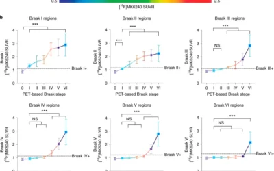 Biomarker modeling of Alzheimer’s disease using PET-based Braak staging.