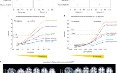 Plasma p-tau231 and p-tau217 as state markers of amyloid-β pathology in preclinical Alzheimer’s disease.