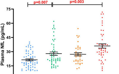 Brain atrophy and white matter hyperintensities are independently associated with plasma neurofilament light chain in an Asian cohort of cognitively impaired patients with concomitant cerebral small vessel disease.