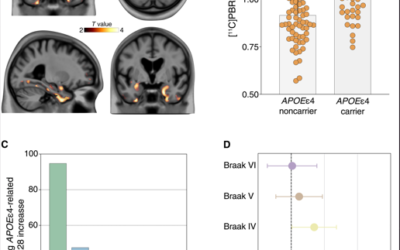 APOEε4 associates with microglial activation independently of Aβ plaques and tau tangles.