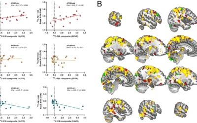 APOE ε4 gene dose effect on imaging and blood biomarkers of neuroinflammation and beta-amyloid in cognitively unimpaired elderly.