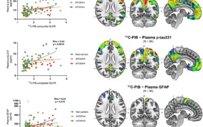 Head-to-head comparison of plasma p-tau181, p-tau231 and glial fibrillary acidic protein in clinically unimpaired elderly with three levels of APOE4-related risk for Alzheimer’s disease.