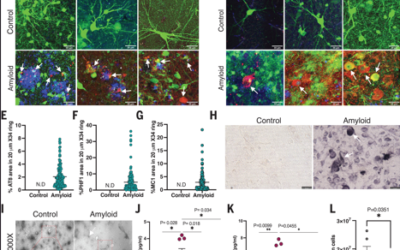 MEG3 activates necroptosis in human neuron xenografts modeling Alzheimer’s disease.