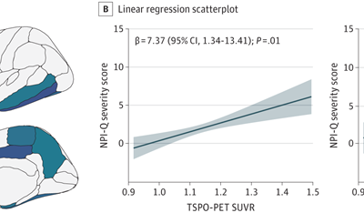 Neuropsychiatric Symptoms and Microglial Activation in Patients with Alzheimer Disease.