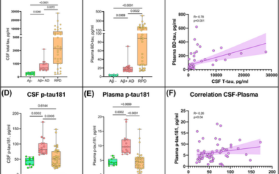 Levels of plasma brain-derived tau and p-tau181 in Alzheimer’s disease and rapidly progressive dementias.