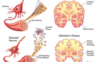 Building sustainable neuroscience capacity in Africa: the role of non-profit organisations.