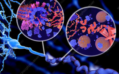 18F-Flortaucipir (AV1451) imaging identifies grey matter atrophy in retired athletes.
