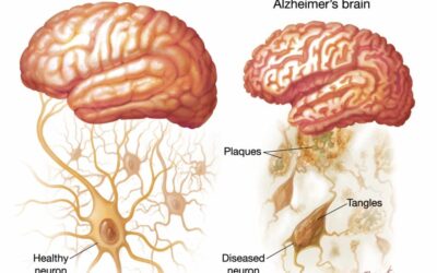 Developing Science Communication in Africa: Undergraduate and Graduate Students should be Trained and Actively Involved in Outreach Activity Development and Implementation.