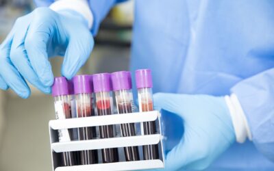 Association of Plasma Brain-Derived Tau With Functional Outcome After Ischemic Stroke.