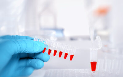 Editorial: Blood Biomarkers of Neurodegenerative Diseases.