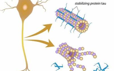 Plasma Brain-Derived Tau in Prognosis of Large Vessel Occlusion Ischemic Stroke.