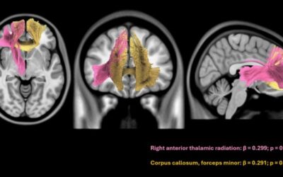Impact of cardiometabolic factors and AD plasma biomarkers on white matter hyperintensities volume in individuals with cognitive complaints from the global south.