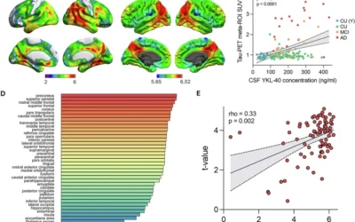 APOE ε4 potentiates tau related reactive astrogliosis assessed by cerebrospinal fluid YKL40 in Alzheimer’s disease.
